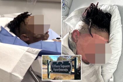 Georgia boy, 12, left with severe burns after 3 friends pour boiling water on him during sleepover ‘prank’