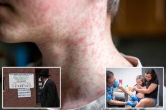 New York City confirms two unrelated measles cases