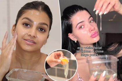Egg-white facials are a controversial, viral skin trend, bird flu be damned — but experts have a big warning about it