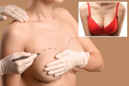Women are keeping their perky boobs while ditching their bras with trendy new surgery
