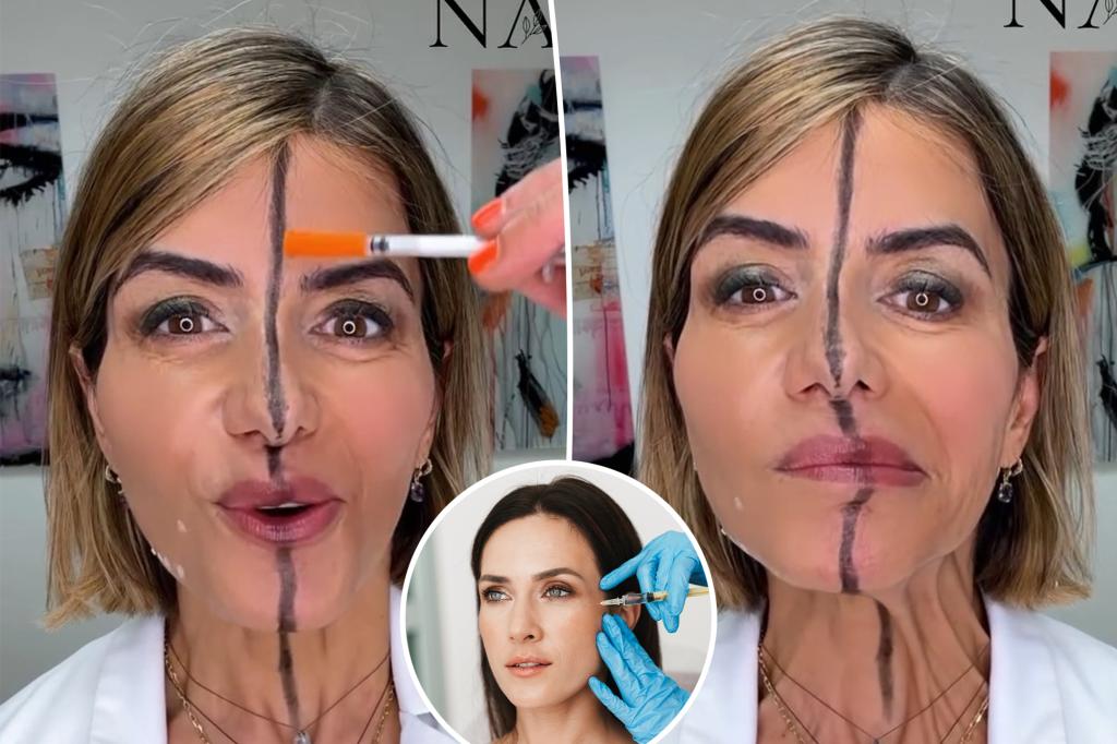 Doctor injects Botox into only one side of her own face — revealing an unexpected, scary contrast