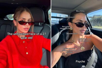 Inside Gen Z’s obsession with ‘tweakments’ — the plastic surgery trend to create a natural beauty look