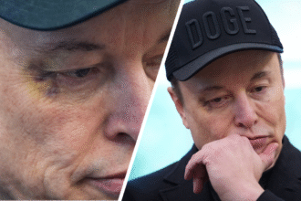 Elon Musk sports BLACK EYE in Oval meeting with Trump