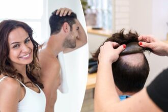 Bald men are resurrecting the toupee — here’s what women think about the throwback style