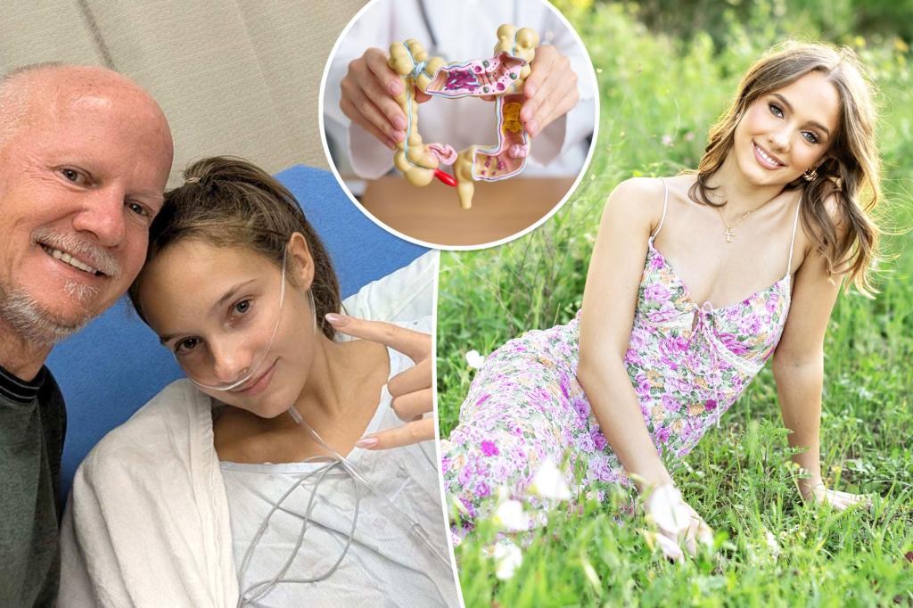 Exclusive | I thought I was a healthy teen — until one overlooked symptom led to a chronic diagnosis