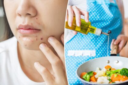 A common cooking mistake could be making you break out — it has nothing to do with your diet