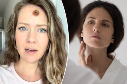 Single mom, 33, shares PSA about ‘small’ sign that turned out to be ‘gruesome’ cancer: ‘People should get the shock value’
