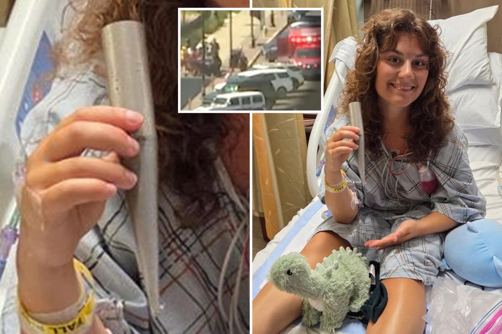 Jersey shore lifeguard impaled by umbrella in freak accident is back at the beach: ‘It’s all good’