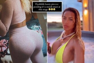 ‘Model’ traveled to the Caribbean to get butt implants — and they fell out: ‘My implant was hanging’