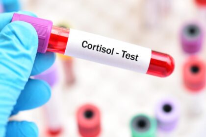 I Got a Cortisol Blood Test. What I Learned About My Stress Was Important, but Not Fun