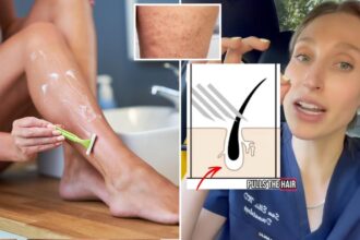 Dermatologist reveals her counterintuitive tip to prevent ingrown hairs after shaving