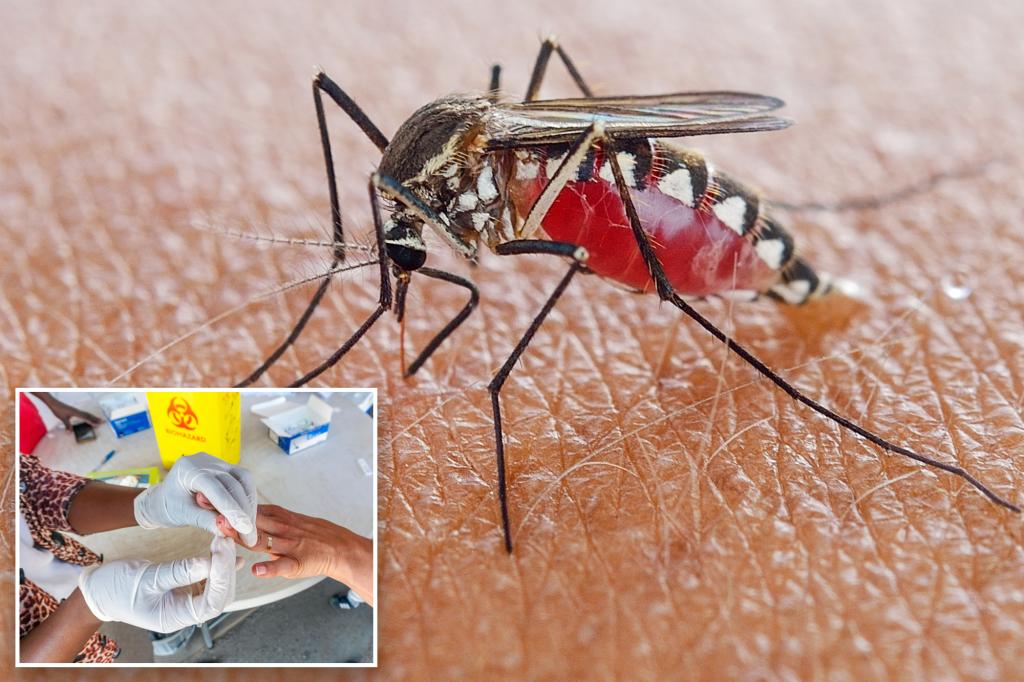 NJ malaria case is first acquired locally since 1998