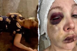 Cincinnati beatdown victim reveals ‘very bad brain trauma’ in first remarks since viral assault
