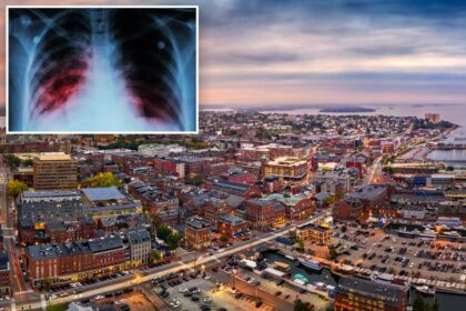 Three people in Maine have active tuberculosis, the world’s deadliest disease