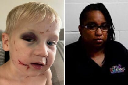 Georgia day care worker who allegedly beat 1-year-old boy black and blue released on bail