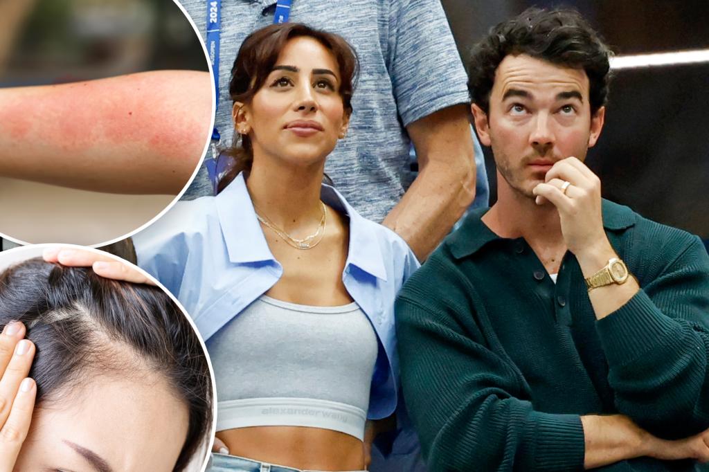Kevin Jonas’ wife Danielle Jonas was diagnosed with Lyme disease after experiencing this ‘very traumatic’ symptom