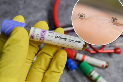 New York health officials confirm state’s first locally acquired case of chikungunya virus