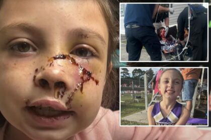 Alabama girl, 9, mauled by dog that ‘grabbed’ her face, leaving brutal injuries