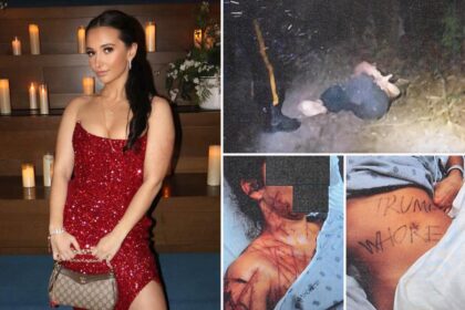 Ex-GOP aide paid fetish artist to mutilate her, claimed it was an anti-Trump attack: court docs