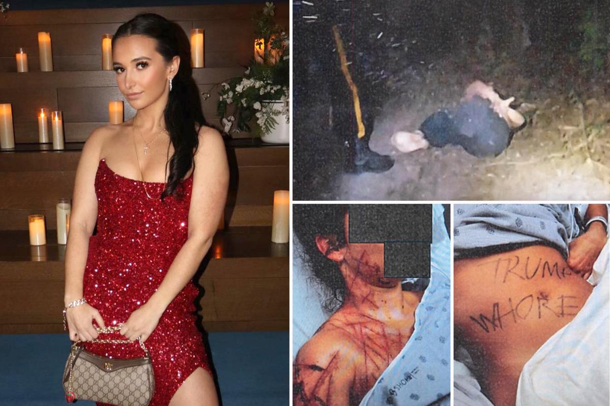 Ex-GOP aide paid fetish artist to mutilate her, claimed it was an anti-Trump attack: court docs