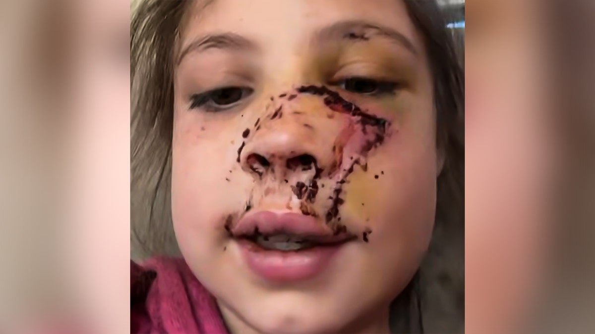 Delyla McCay's injuries.