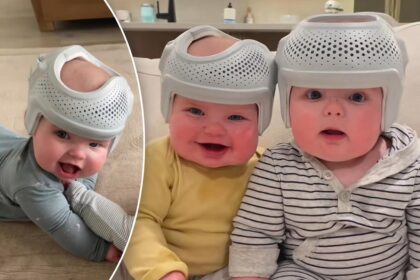 My twin babies wear 0 helmets for 23 hours a day to reshape their flat heads — haters say I’m ‘crazy,’ but it’s for their own good