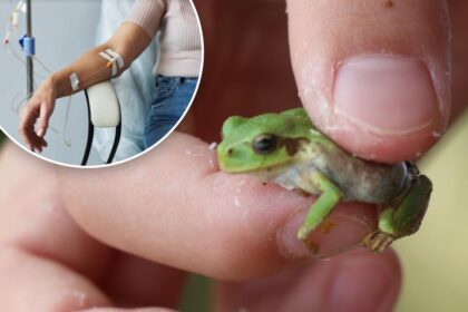 How the guts of Japanese frogs could cure colorectal cancer — even better than chemo: study