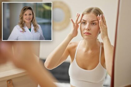 I’m a dermatologist — how I can always tell if a person will be more wrinkly when they get older