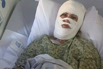 Georgia woman hospitalized after attacker hurls corrosive chemical during evening walk