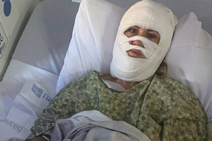 Georgia woman hospitalized after attacker hurls corrosive chemical during evening walk