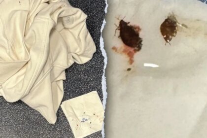 Virginia family alleges bed bugs bit them during transatlantic flight, suing Delta and KLM airlines