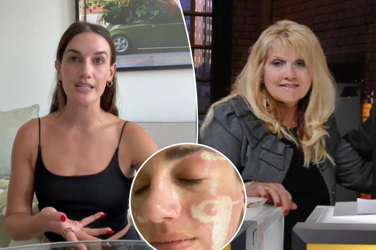 Celebrity esthetician sued for K after client says she was left ‘severely burned and permanently scarred’