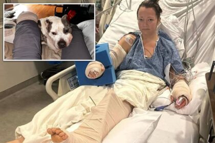 Tennessee mom loses leg in attack by her own pit bull that left limb ‘basically hanging off’