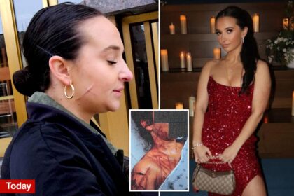 Exclusive | Ex-NJ GOP aide still carries visible scars after she paid fetish artist to carve her up as part of Trump attack hoax