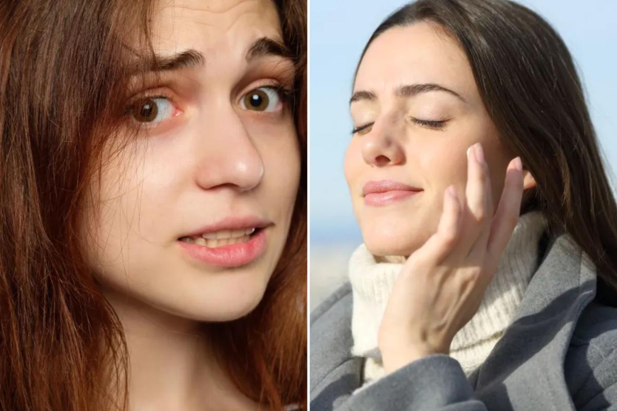 Flu season is wreaking havoc on your skin — it’s more than just the ‘winter uglies,’ here’s how to beat it