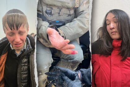 Anti-ICE agitator allegedly bites off federal officer’s finger during Minneapolis attack