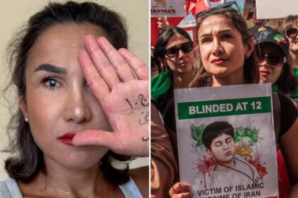 Iranian woman who lost her eye after being shot by the Revolutionary Guard slams Kamala Harris’ response to the bombing