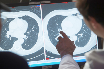A cure for cancer would deliver 5T economic windfall, report says