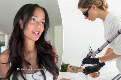 Influencer reveals ‘disgusting’ complication of tattoo removal