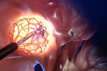 Deep inside the heart: an EU medical breakthrough against arrhythmia