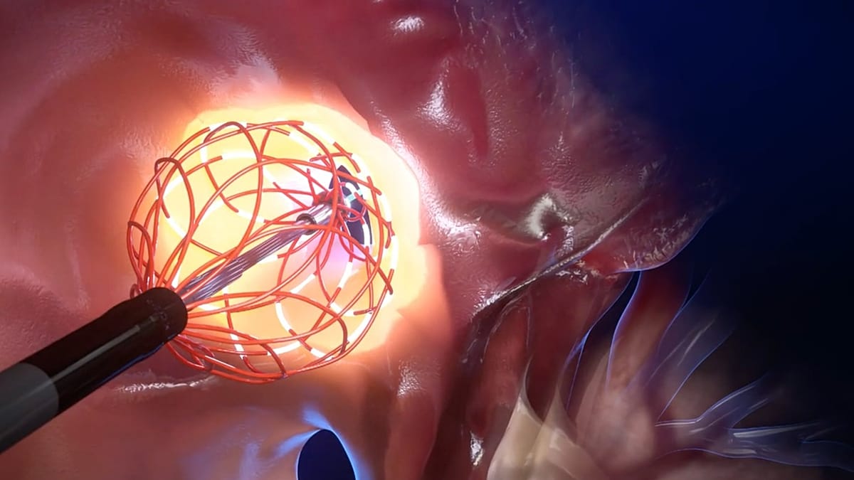 Deep inside the heart: an EU medical breakthrough against arrhythmia
