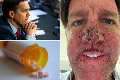 Ex-Sen. Ben Sasse on the ‘nasty drug’ for Stage 4 cancer that makes him ‘bleed out of a whole bunch of parts’