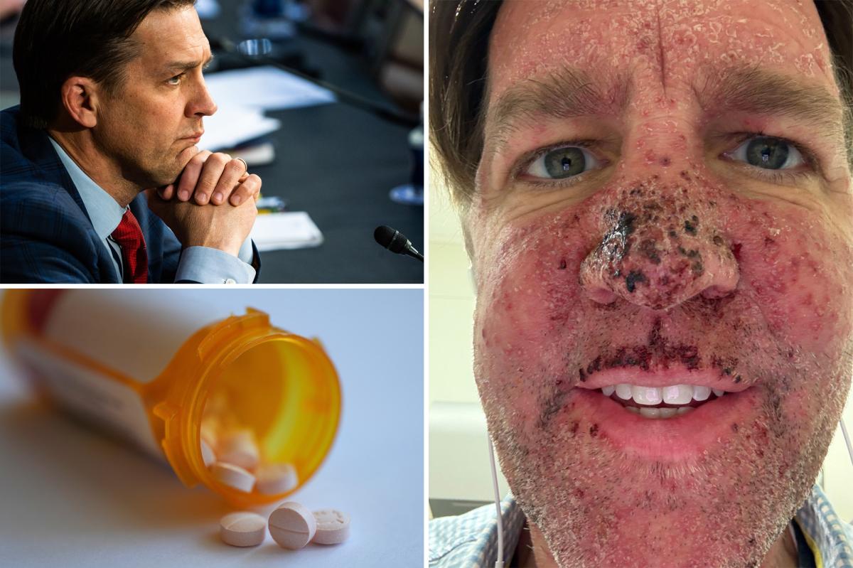 Ex-Sen. Ben Sasse on the ‘nasty drug’ for Stage 4 cancer that makes him ‘bleed out of a whole bunch of parts’