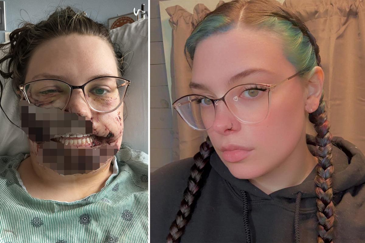 Illinois mom gets face ripped apart by rescue dog after suffering seizure