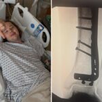 Bluegrass artist Billy Strings breaks leg while skateboarding at his Virginia concert: ‘Feel like such an idiot’