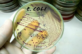 Chinese researcher on US visa pleads guilty to smuggling E. coli into the country