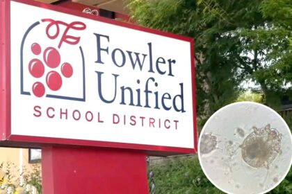 Outbreak of horrific skin-eating disease at California school