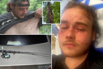 Fisherman survives lightning strike that left him covered in burns: ‘Unluckiest lucky man alive’