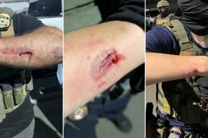 Anti-ICE agitator charged with allegedly biting officers during Delaney Hall clashes