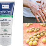 Skin cream sold on Amazon recalled over deadly bacteria risk